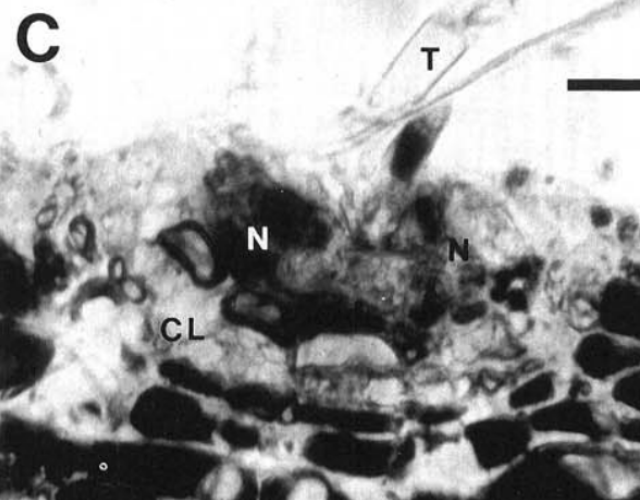 Localized necrosis (Hypersensitive response) 