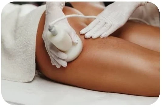 Ultrasound Cavitation-  6 Sessions
