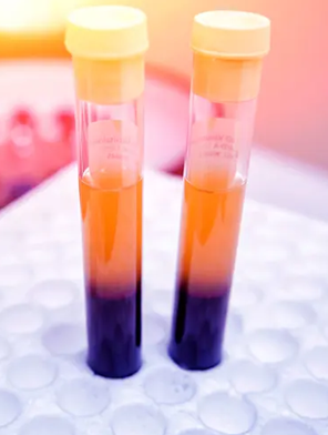 PRP/PRF Treatment