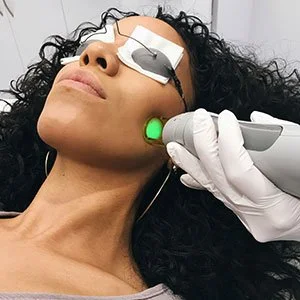 LASER Hair Removal -SMALL