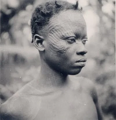 Ichi scarification.jpg