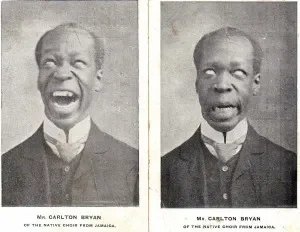 Carlton Bryan ‘pulling a face’, two images from 1906.