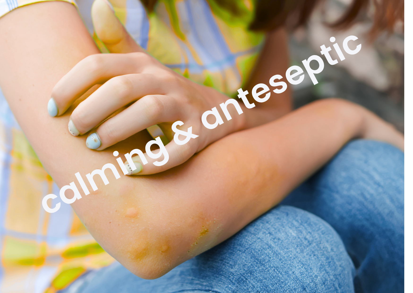 an arm with a sting