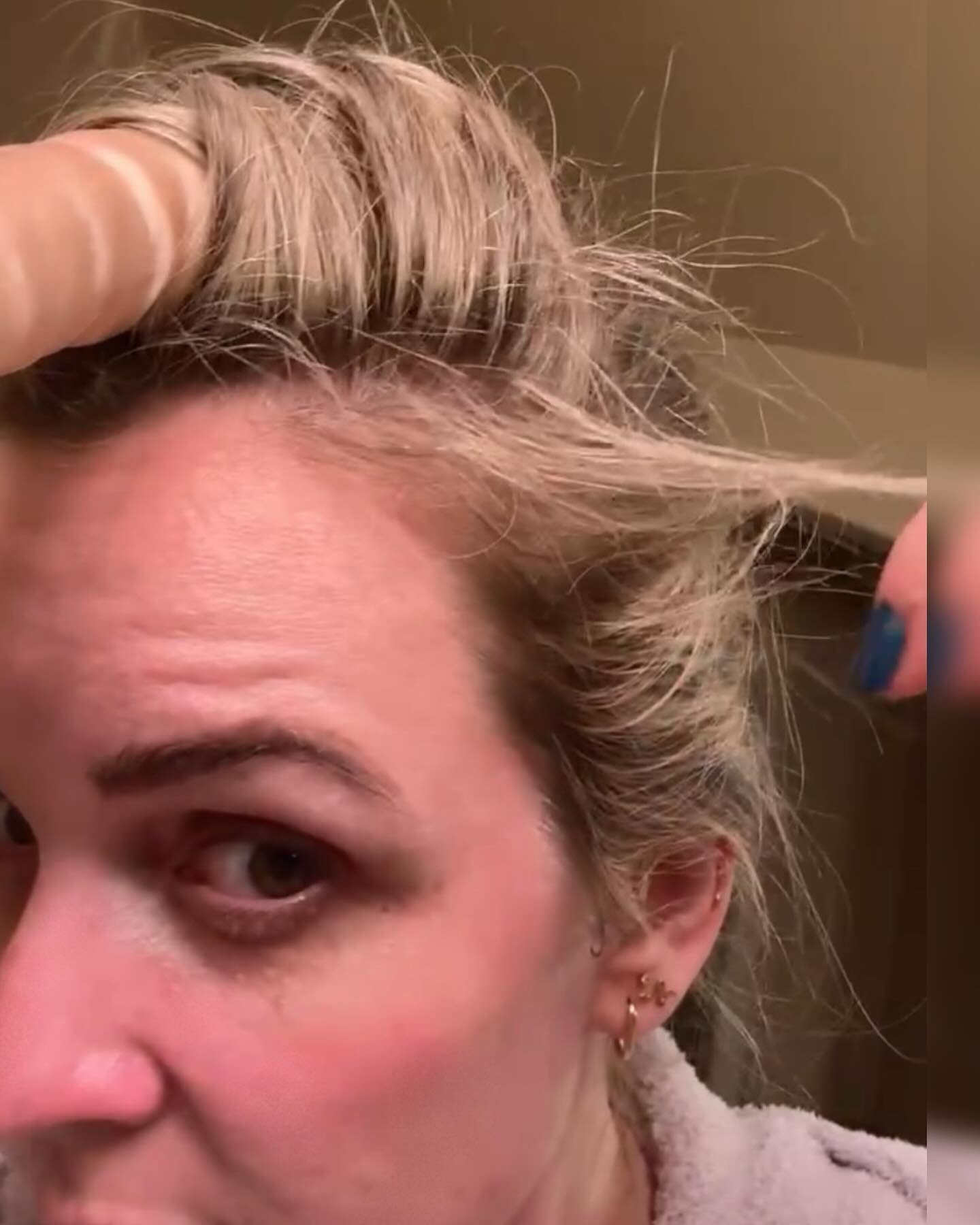 Regrowth is possible! Healthy hair is possible! Keep nurturing your hair with love and dedication. If I&rsquo;ve said it once, I&rsquo;ll say it again: Your hair is your most important accessory! So, stay committed to your healthy hair routines, whet