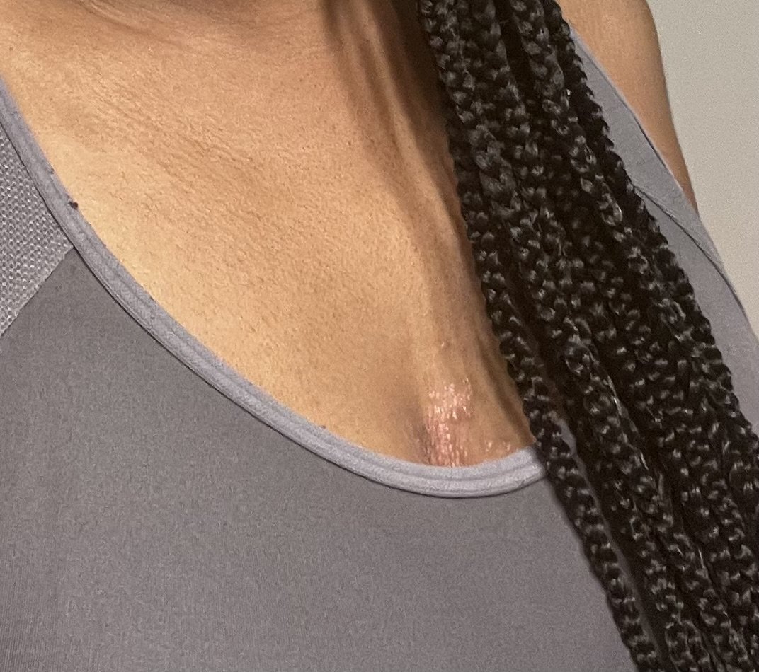 Anti-Plaque Psoriasis Package