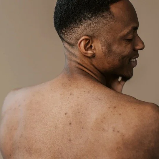 Male clear skin