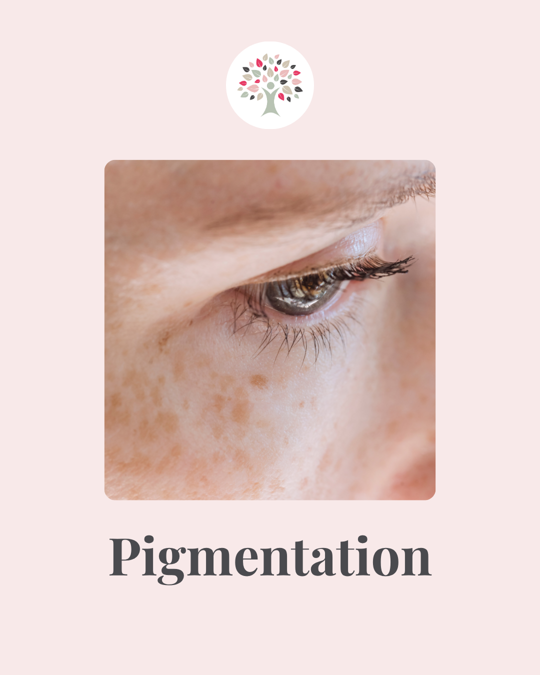 Understanding Pigmentation in Midlife: What Your Skin May Be Telling You 