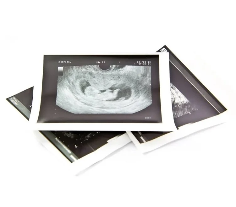 Multiple ultrasound images, with the central one showing a developing fetus, scattered on a white background.