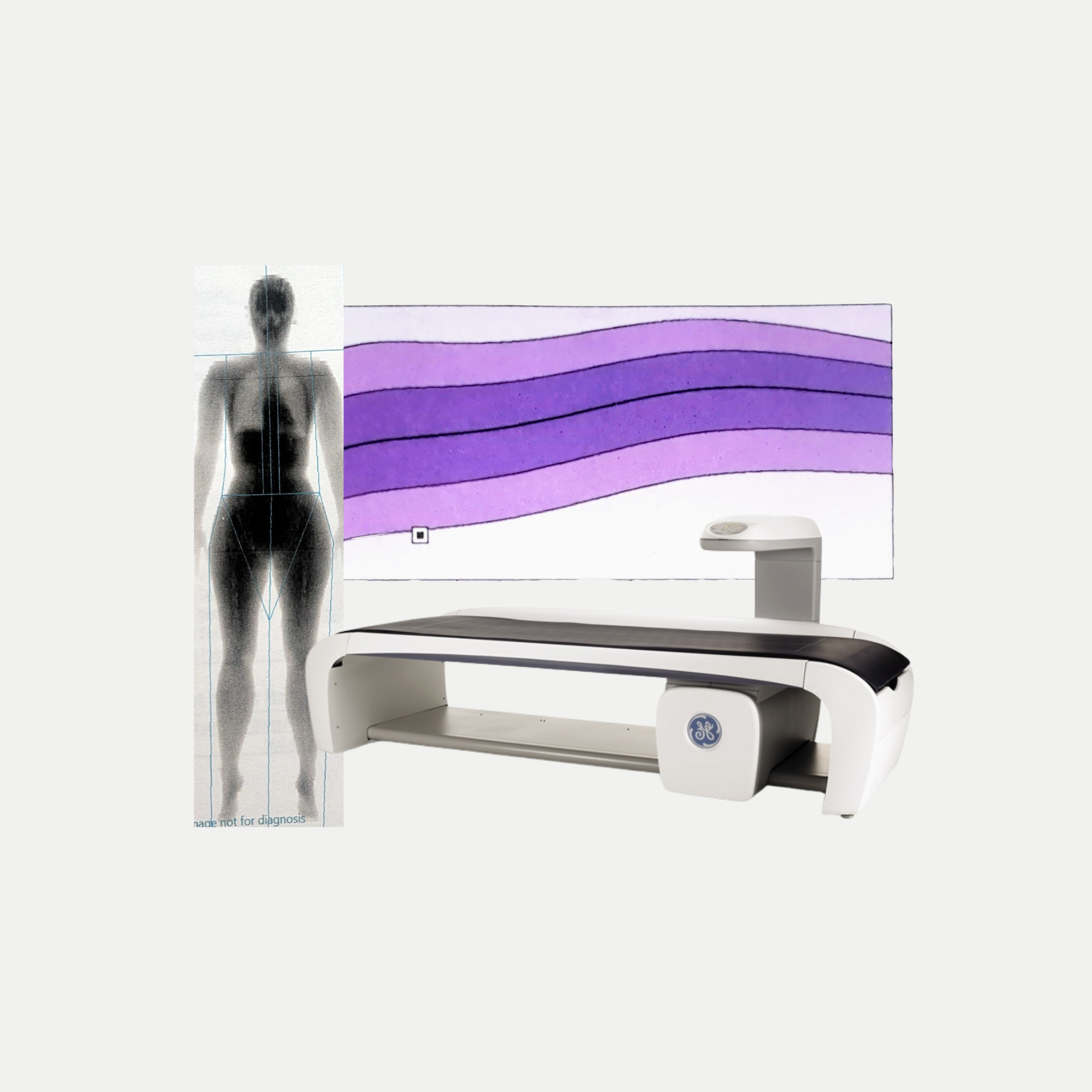 Should You Get a DEXA Scan in 2025? — Midlionnaire