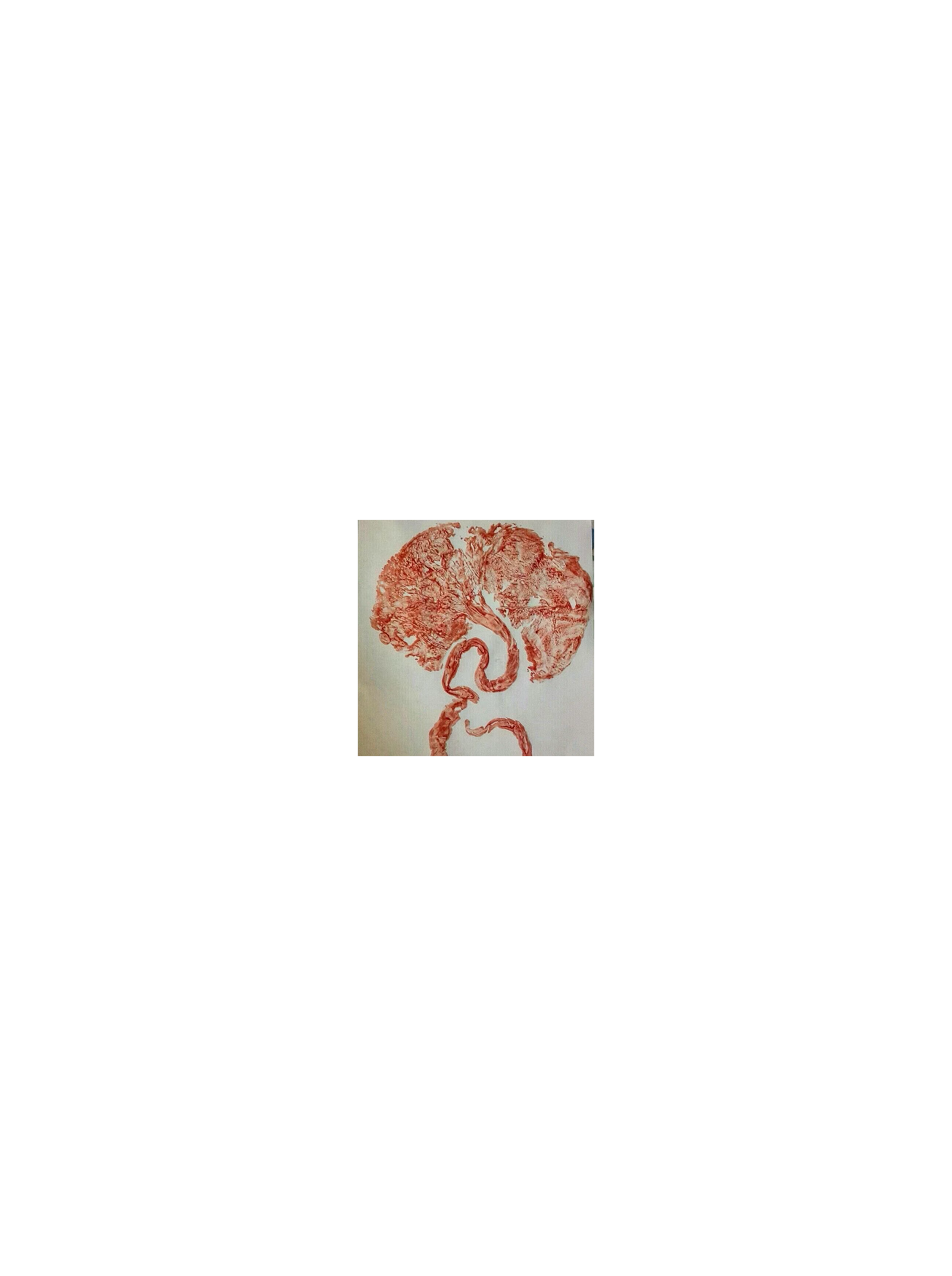 Umbilical print.png