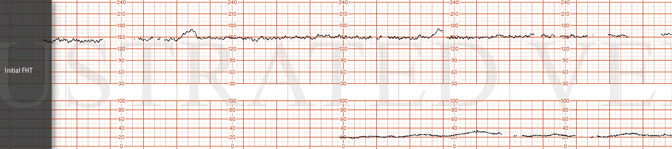 Electronic Fetal Monitoring:Management and Standard of Care Part 2