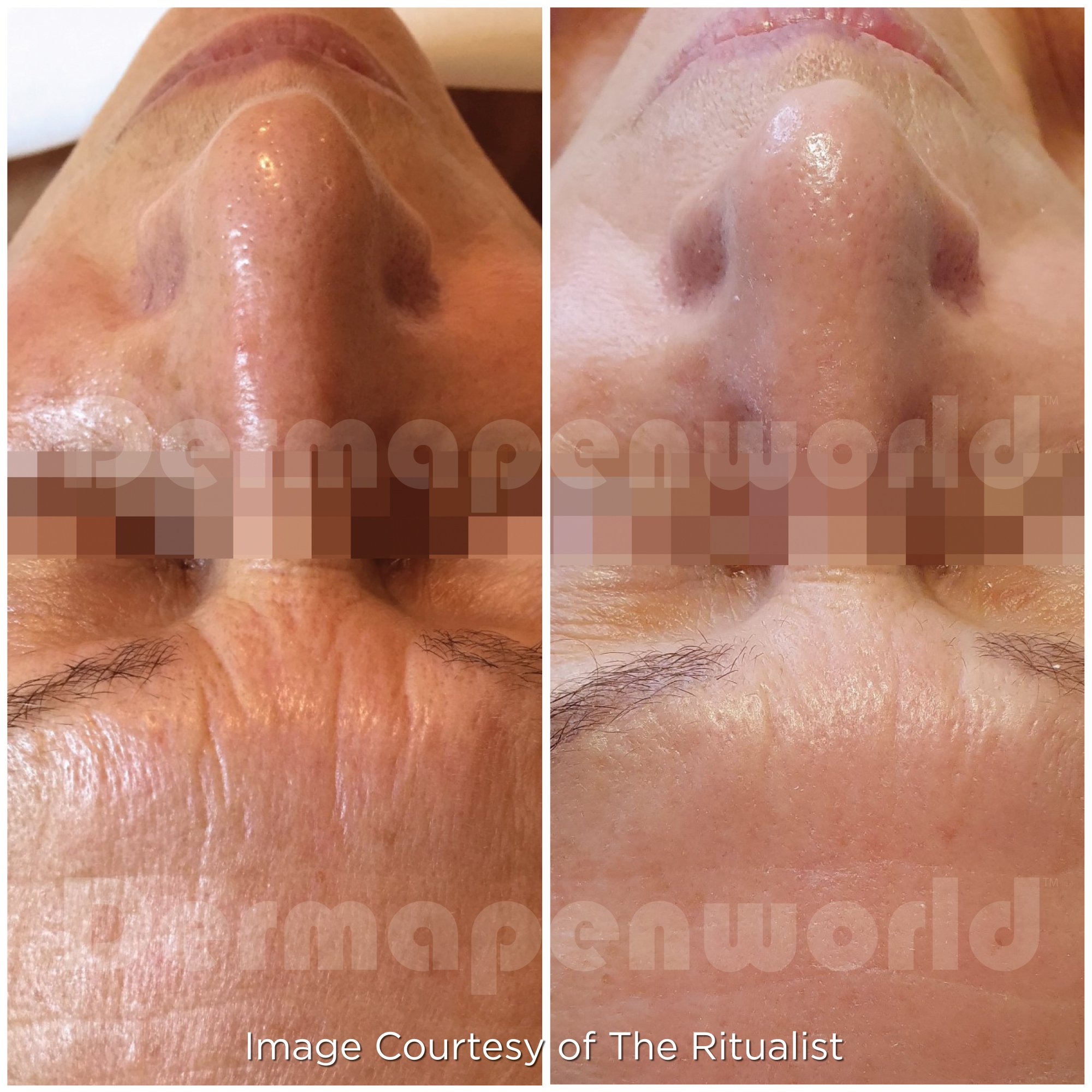 Ageing_Female 16.jpg