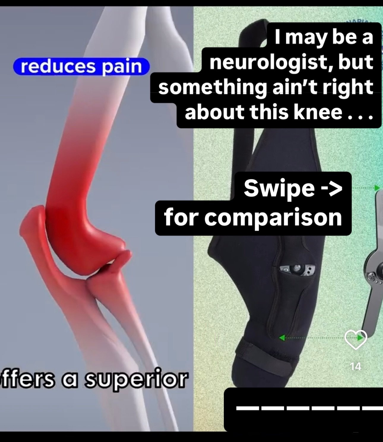 I&rsquo;m all for braces and non-surgical approaches for the right case and informed owners, but I am a stickler when it comes to correct anatomy, especially if you&rsquo;re going to use generative AI. I tried to cover brand as I&rsquo;m not trying t