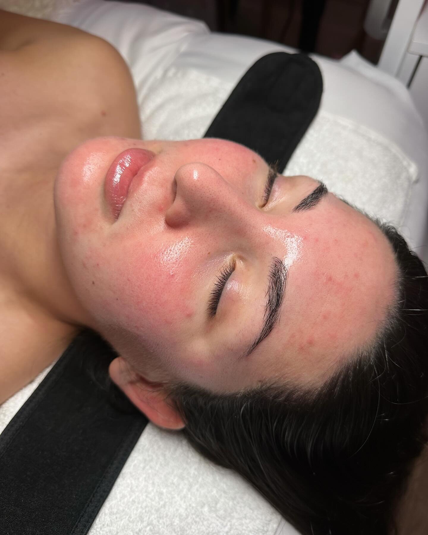Swipe to see the before 😮&zwj;💨

Queen left GLOWING, hydrated, healthy blood flow, exfoliated, acne bacteria killed, and rejuvenated💋

Remember to take advantage of my 20% off all facial treatments for the rest of February 🍓🩷

#utahesthetician #