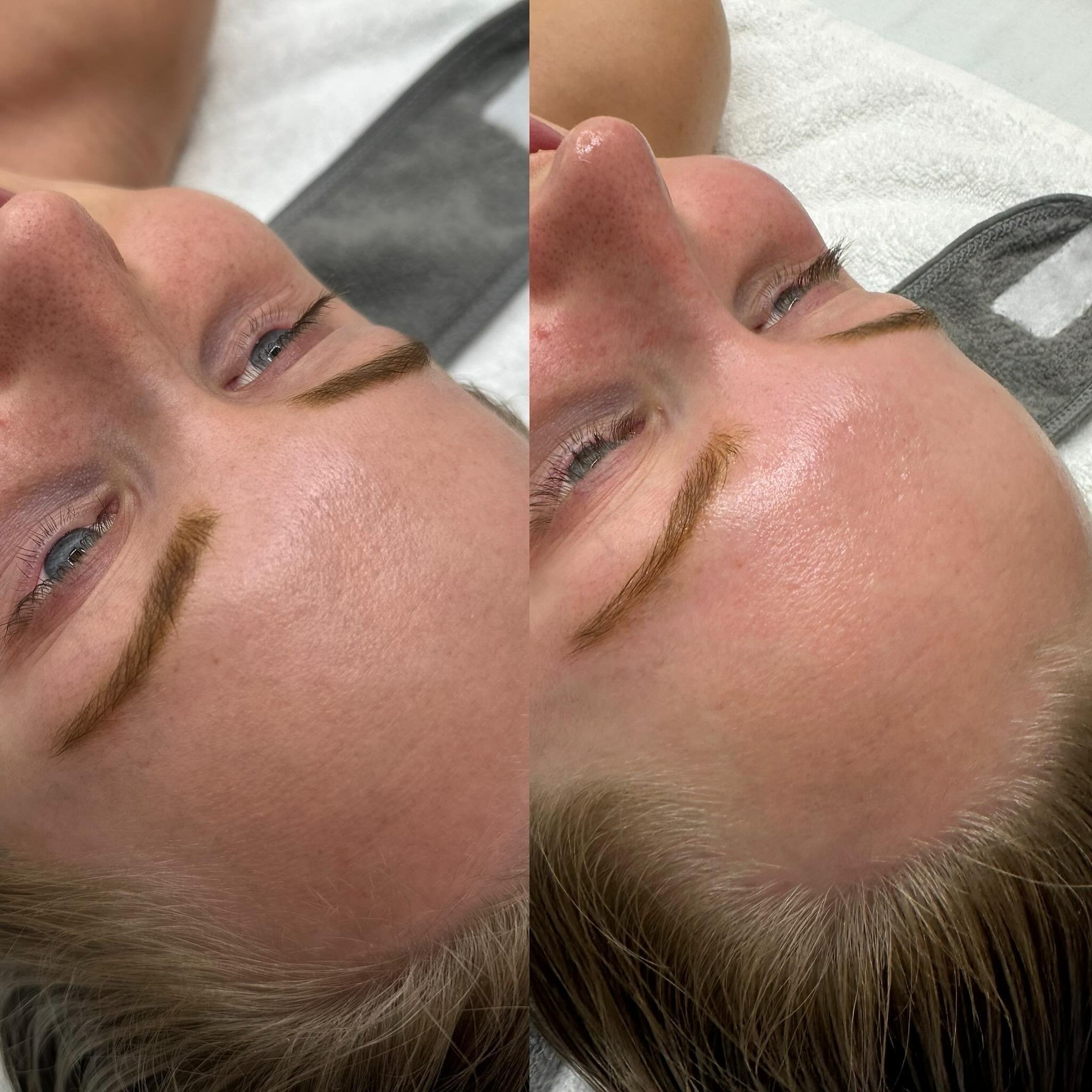 How she came in vs how she left 🫡

She left hydrated, balanced, and has proper circulation🫶🏼

If you needed a sign to get start investing in skincare and treatments, this is it. 

30% off my fav products on my website now 💫🌸

Thank you for choos