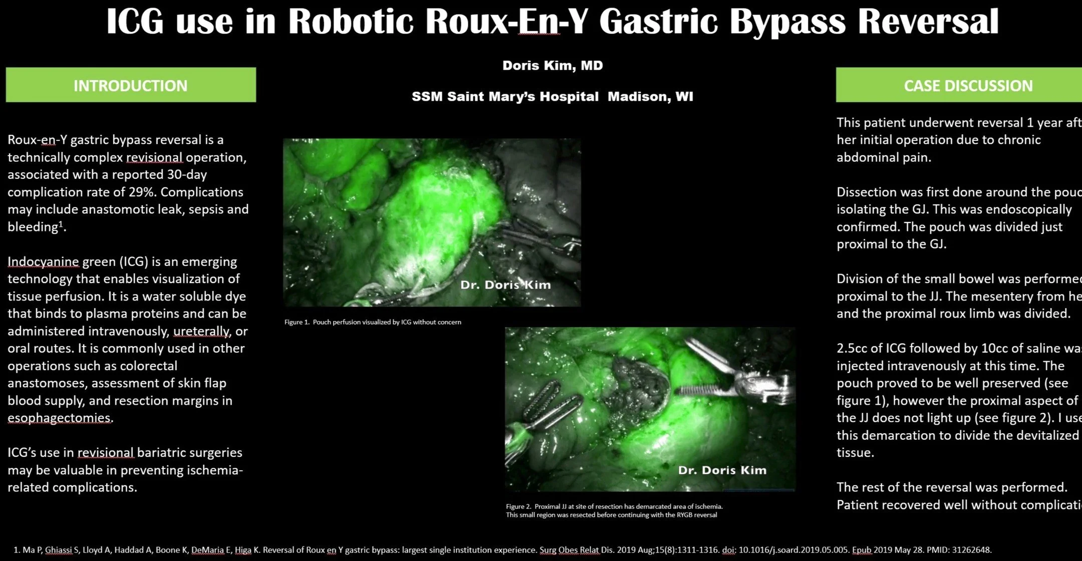 Presented at ASMBS 2025. Revisional bariatric surgery has a high risk of complications. The use of the robotic platform with ICG can help mitigate those risks! Video to come. #bariatricsurgery #intuitivesurgery #roboticsurgery