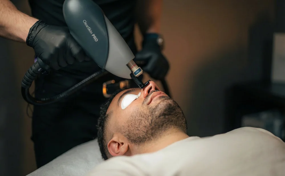 ClearSkin Pro laser rejuvenation