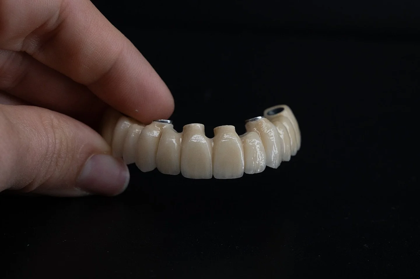 Rehabilitación superior de cerámica sobre estructura metálica.
#rehabilitaciónoral #laboratoriodental #clinicadental #dentalmakeover #dentallab