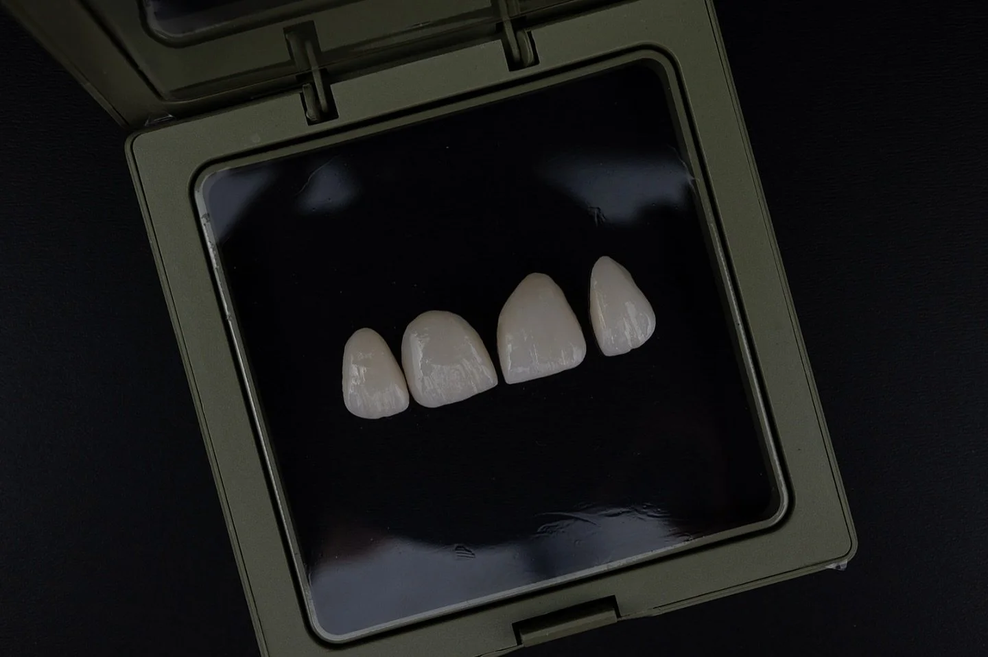 Carillas anteriores.
#carillas #carillasdentales #veneers #dentalveneers #laboratoriodental #laboratoriodentalmadrid #clinicadental