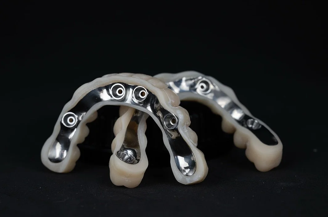 Hoy os ense&ntilde;o una doble rehabilitaci&oacute;n completa: superior e inferior, ambas sobre barra sinterizada de titanio con base mecanizada y recubrimiento en composite.
⠀
Una soluci&oacute;n que ofrece estabilidad, durabilidad y una est&eacute;