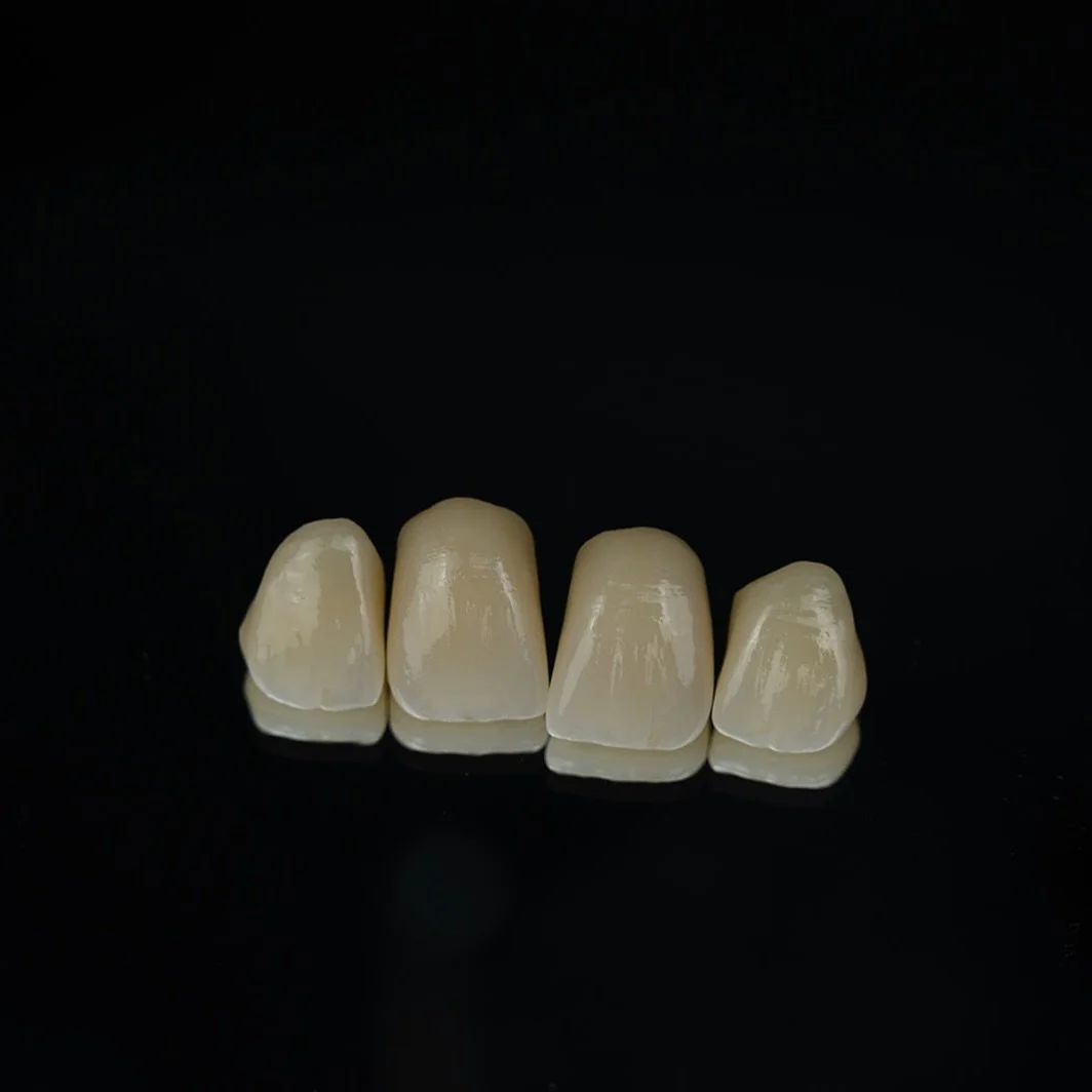 Nuevos incisivos🥰

#dentalhealth #dentallab #protesisdental #laboratoriodentalmadrid #protesisdentales #clinicadental