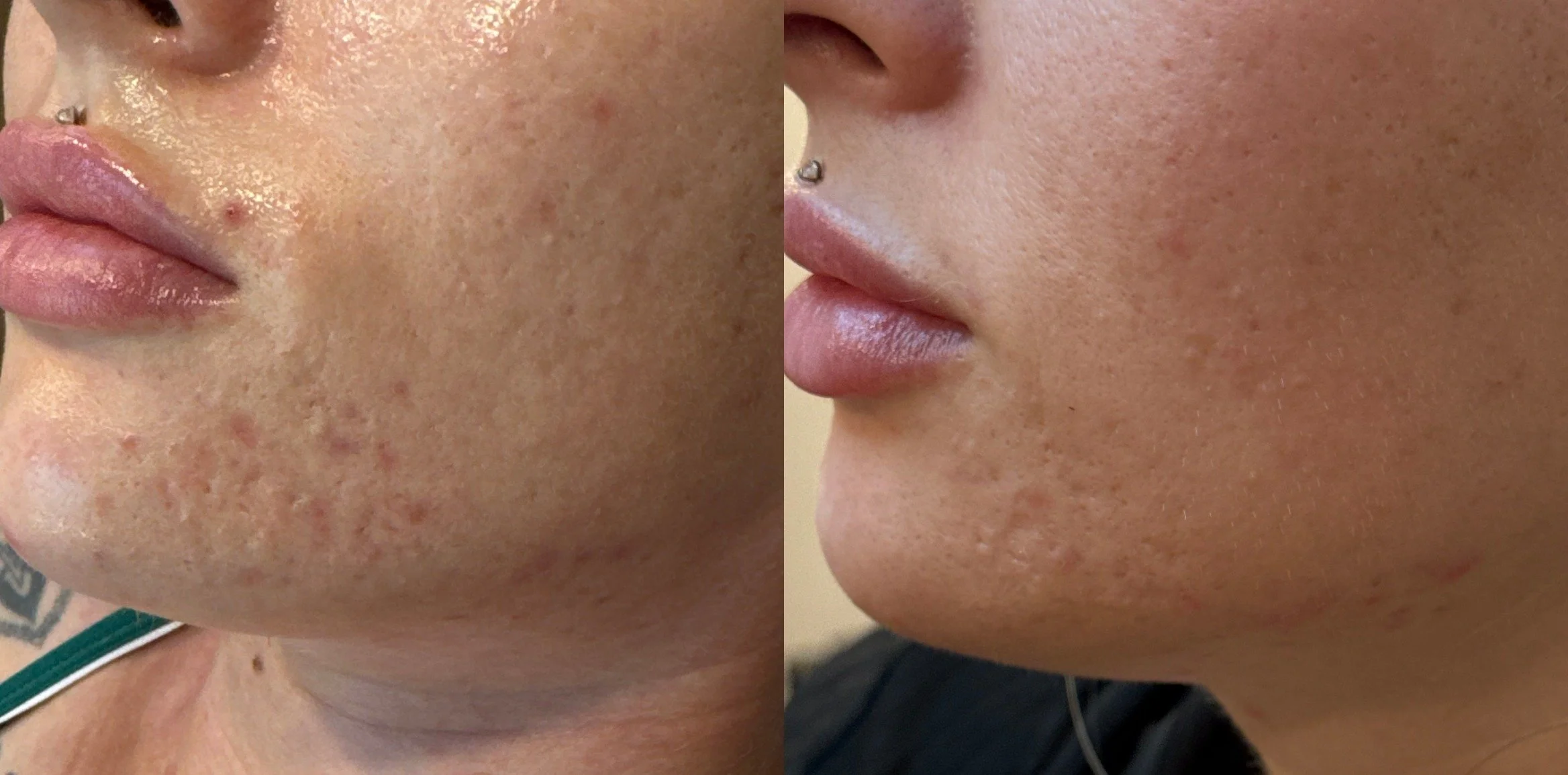 image.jpg_image.jpg_1754408046233comparison.jpeg