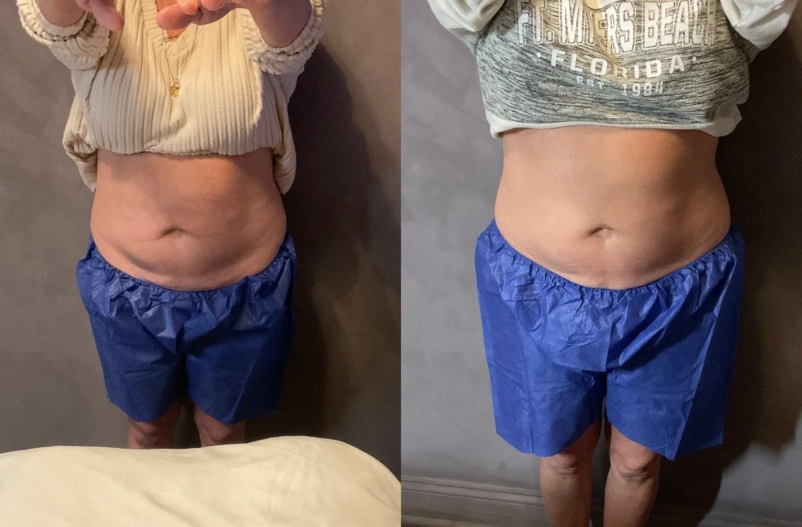 Before photo_BEFORE_1754403106345comparison.jpeg