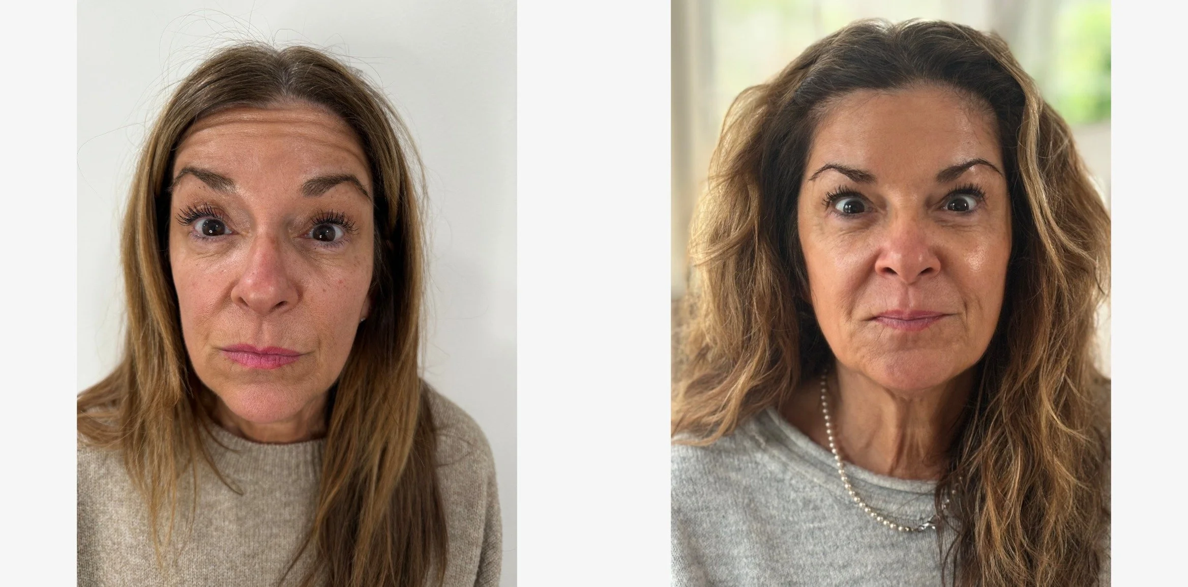 Profile R_IMG_2485.jpeg_1754408572678comparison.jpeg