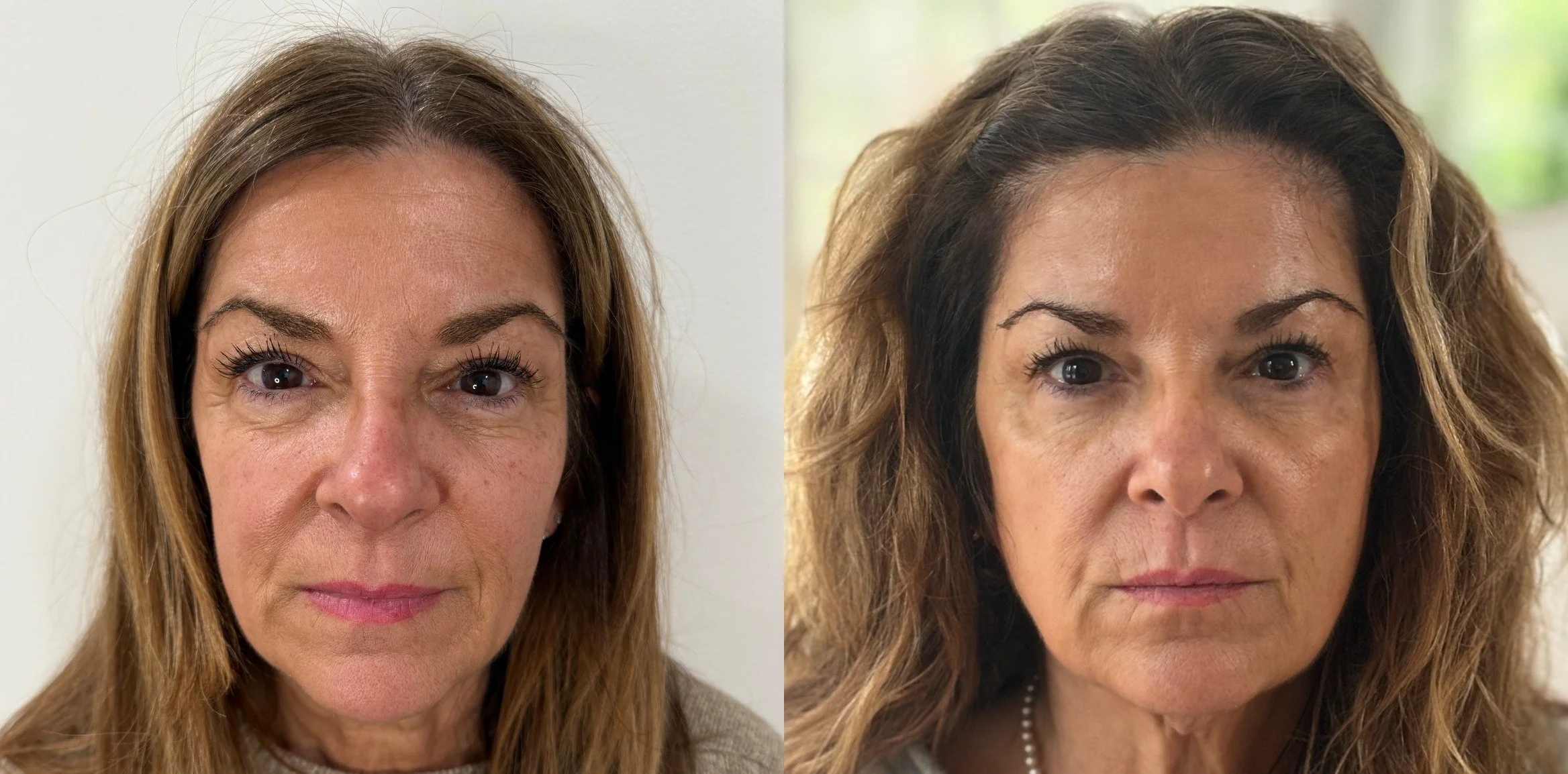 Before photo_IMG_2483.jpeg_1754408538859comparison.jpeg