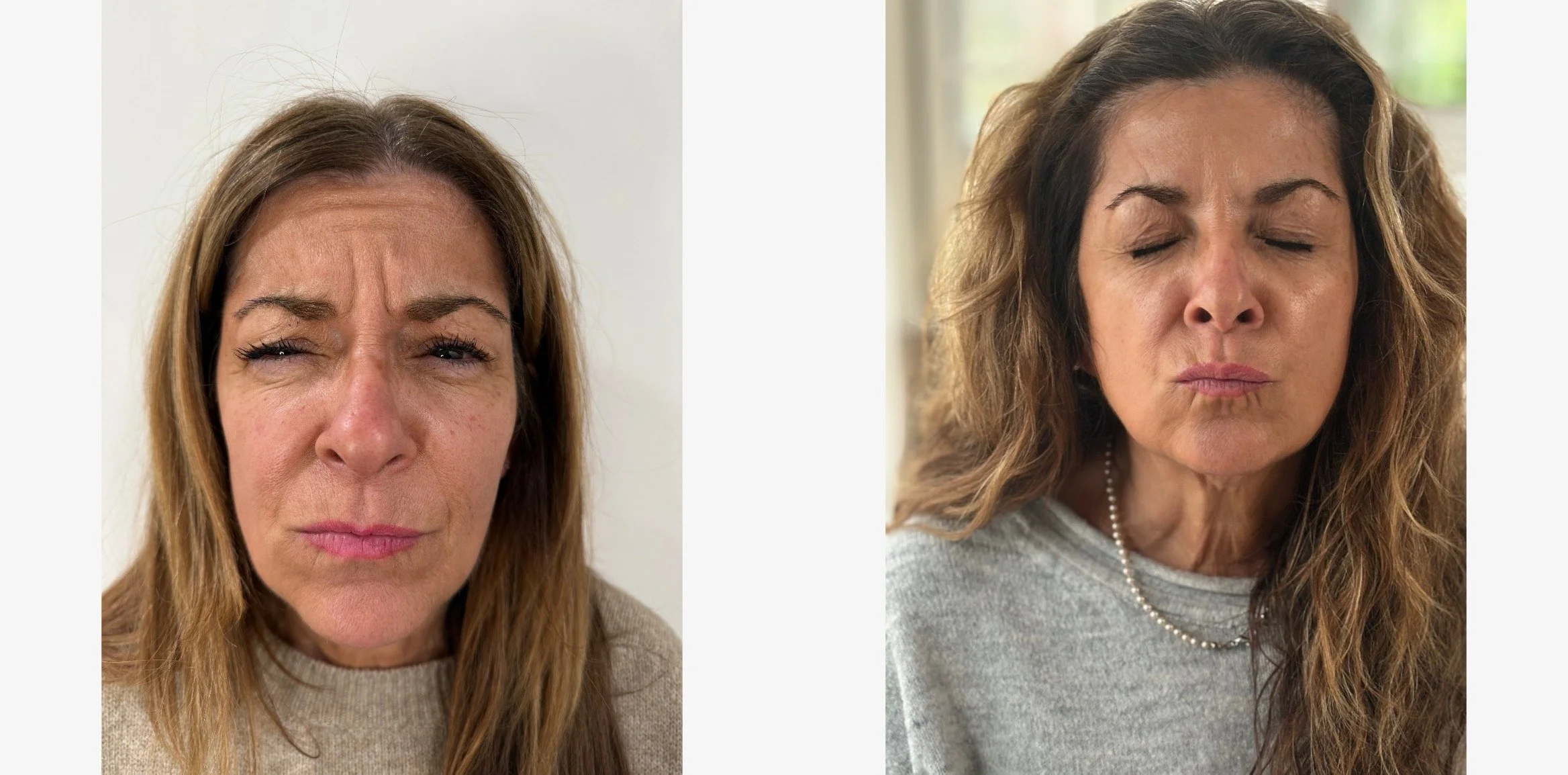 Before photo 3_4 L_IMG_2484.jpeg_1754408560633comparison.jpeg