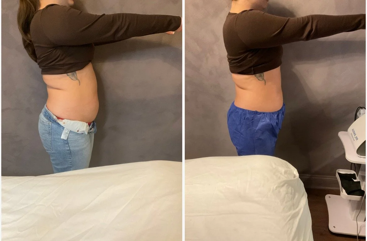 Before R profile_After R profile_1754403263581comparison.jpeg