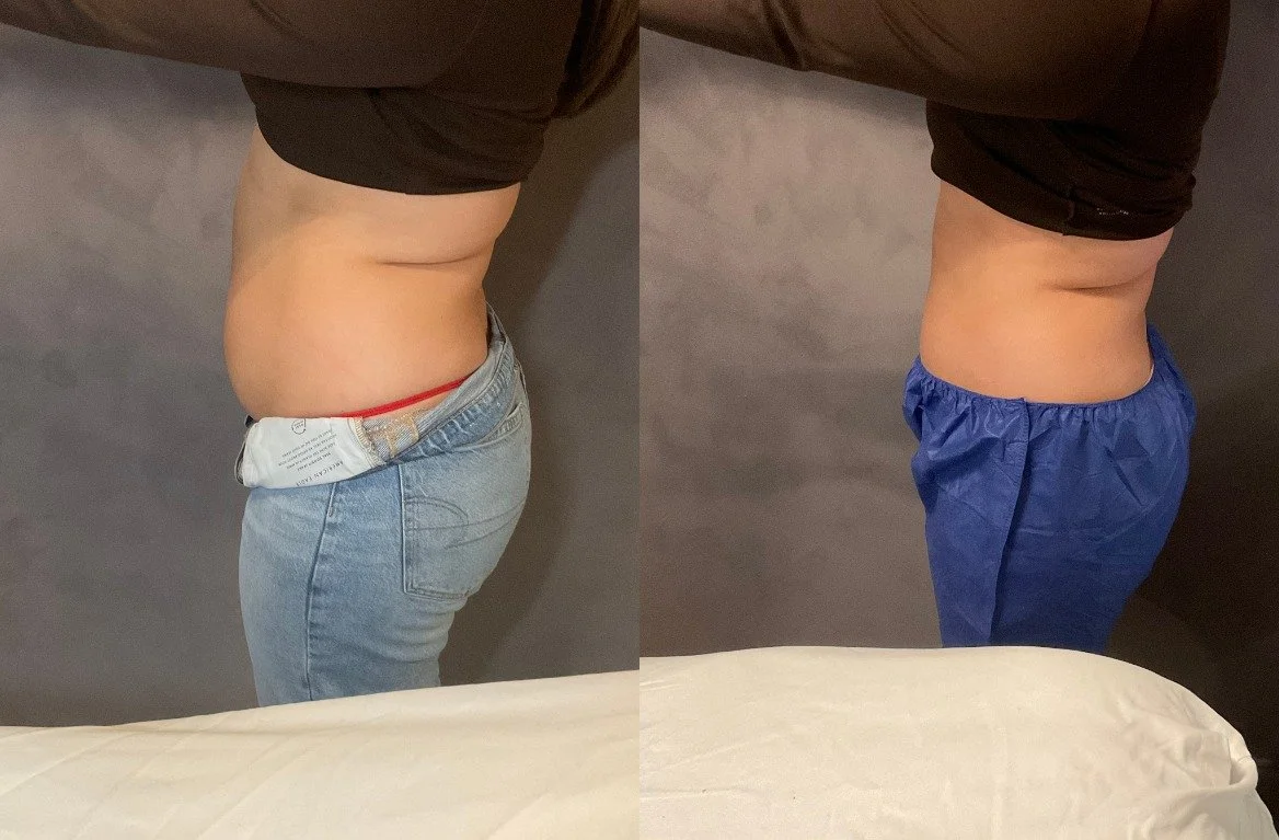 Before L profile_After L profile_1754403284362comparison.jpeg