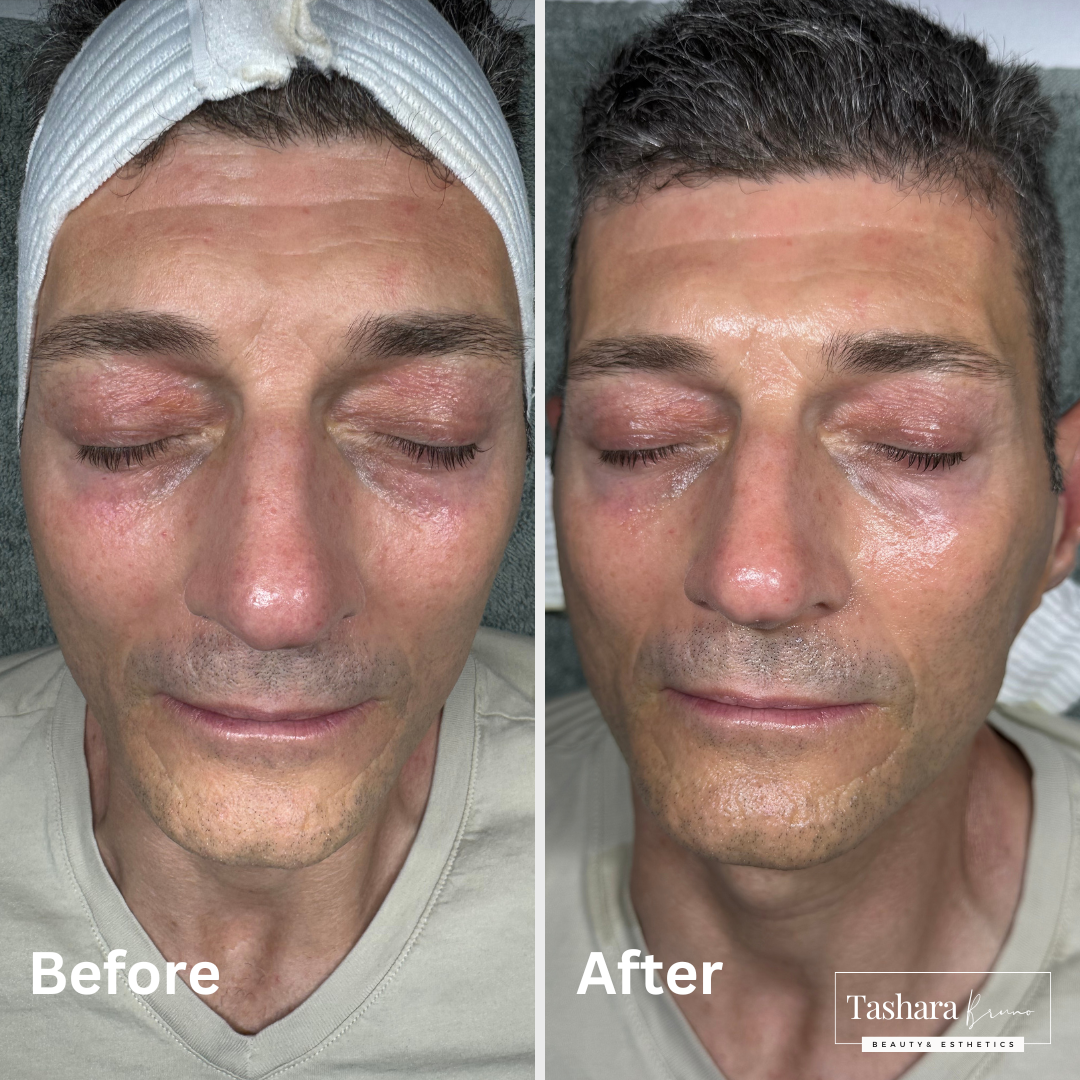 before and afters and ig post (38).png