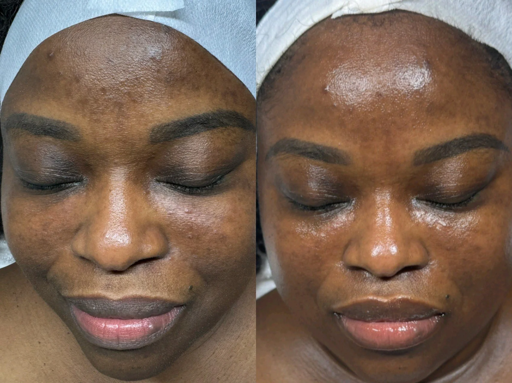 Custom Facial 