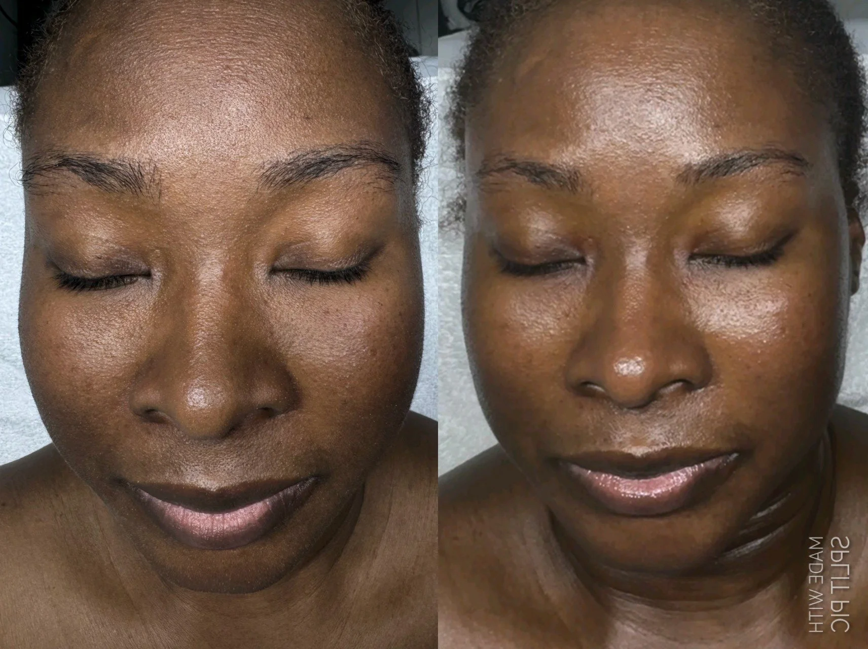 Custom Facial