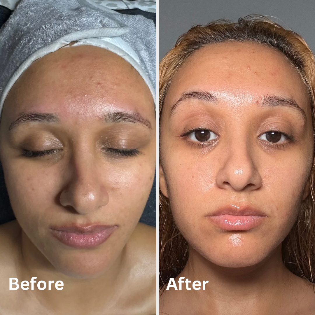 before and afters and ig post 3.PNG