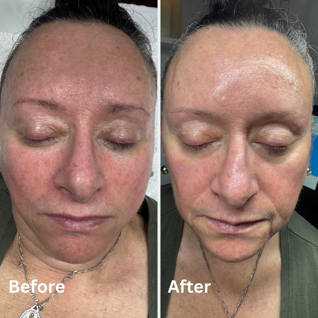 before and afters and ig post (33).png