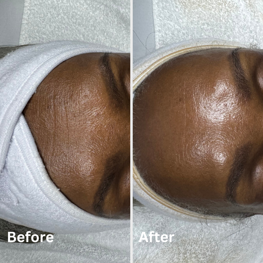 before and afters and ig post (34).png