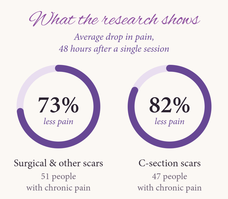 What the research shows: 73% less pain on average 48 hours after one scar release session (51 people with surgical and other scars), and 82% less pain on average 48 hours after one session on C-section scars (47 people)