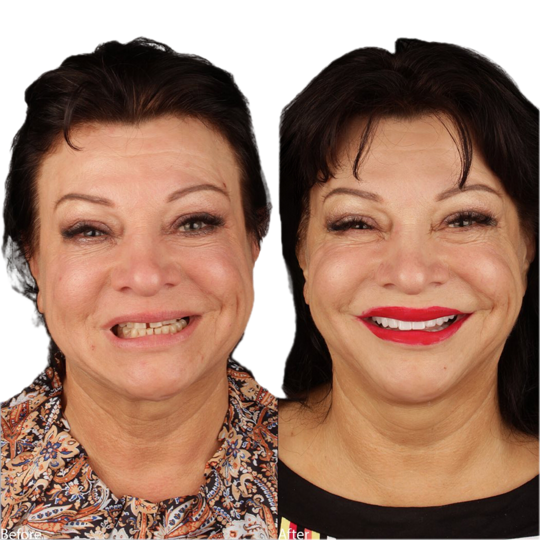 Dental Work, Pic 1.png