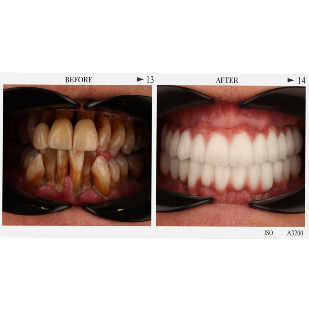 Patient 1, Page 2.png