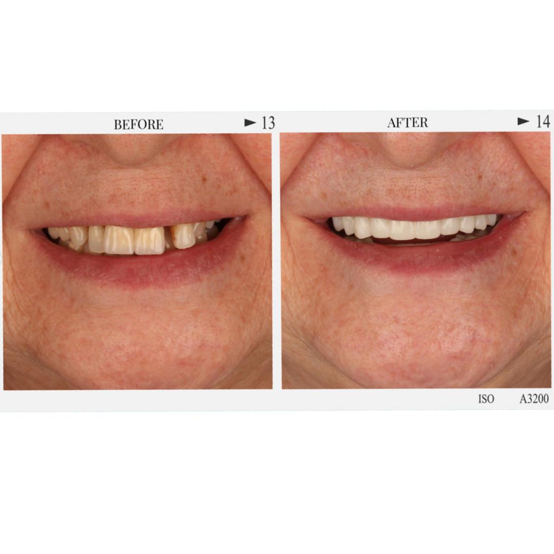 Patient 5, Page 2.png