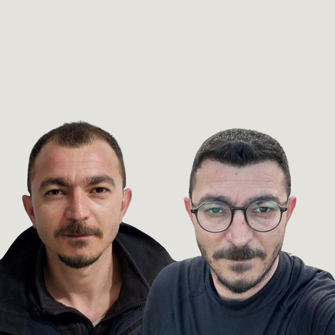 Hair Transplantation, Pic 4.png