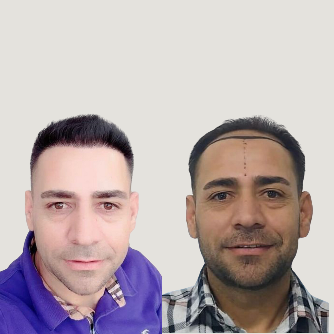 Hair Transformation, Pic 1.png