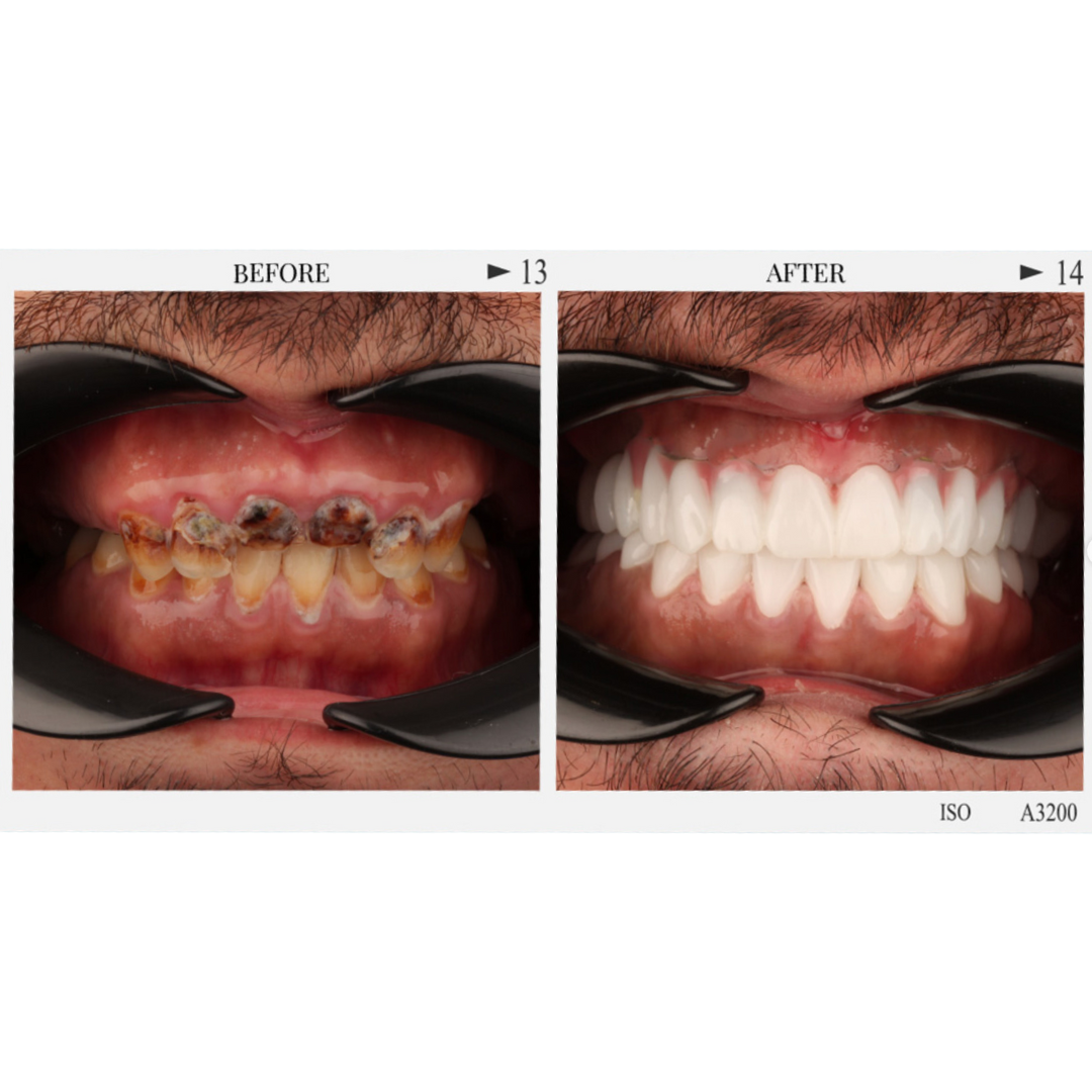 Patient 4, Page 2.png