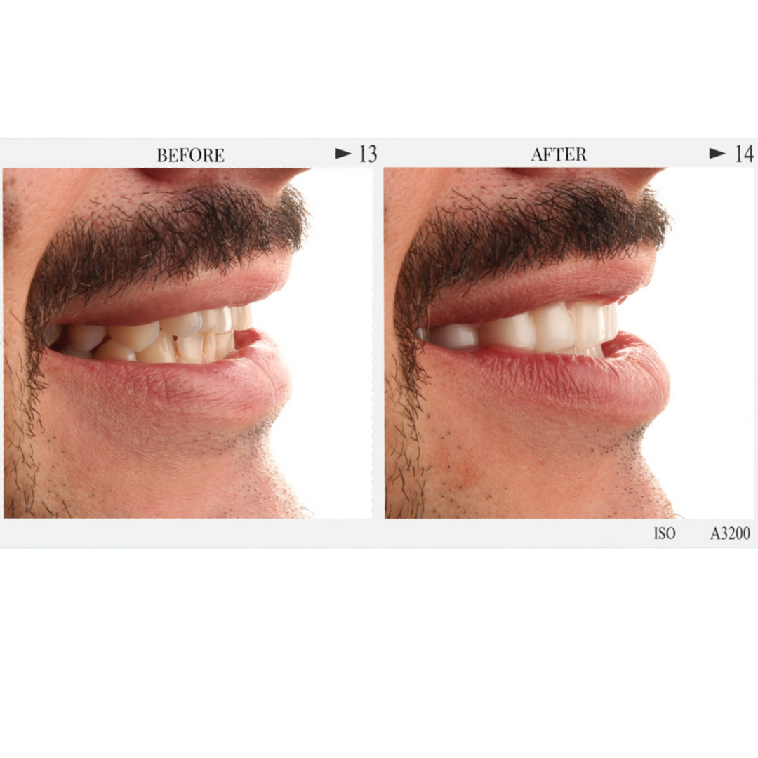 Patient 6, Page 2.png