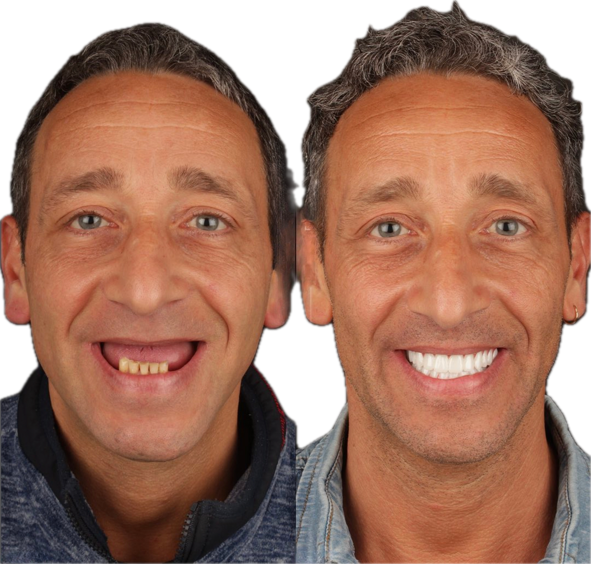 Dental Work, Pic 4.png