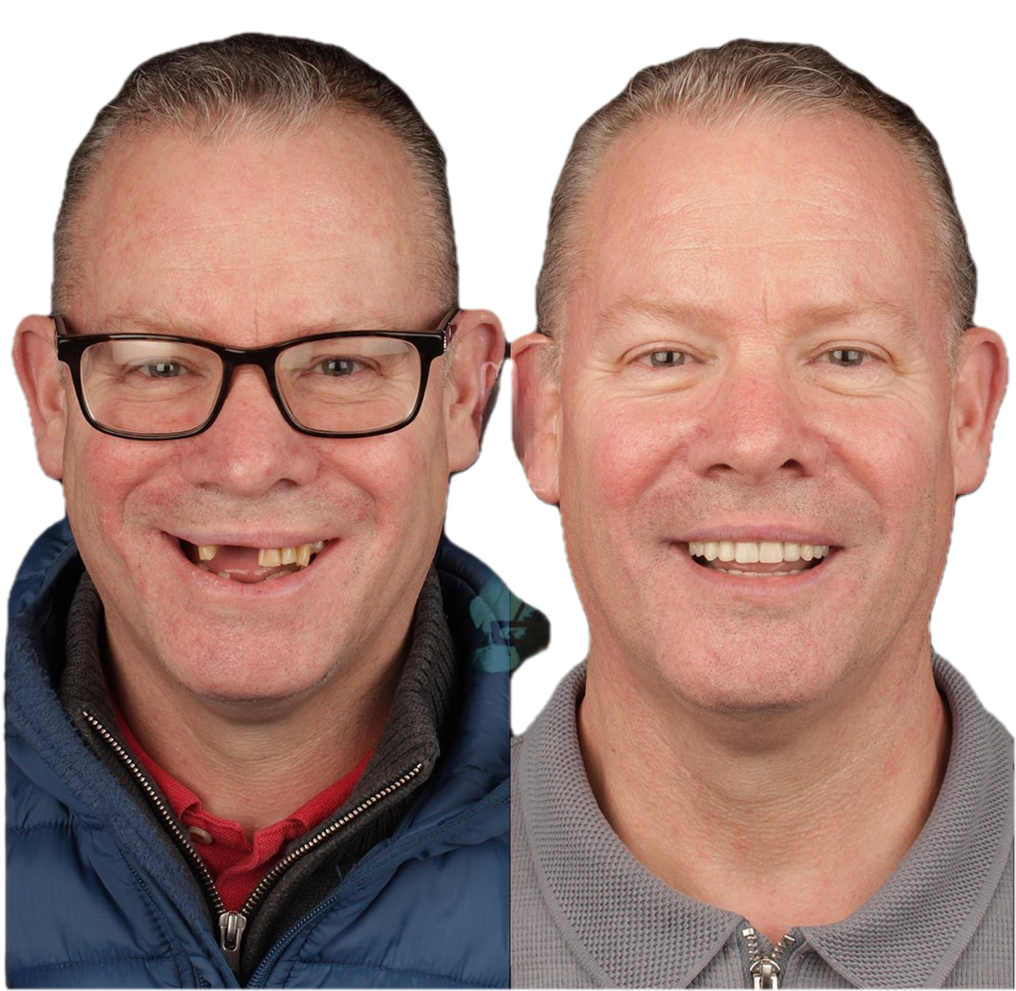 Dental Work, Pic 3.png