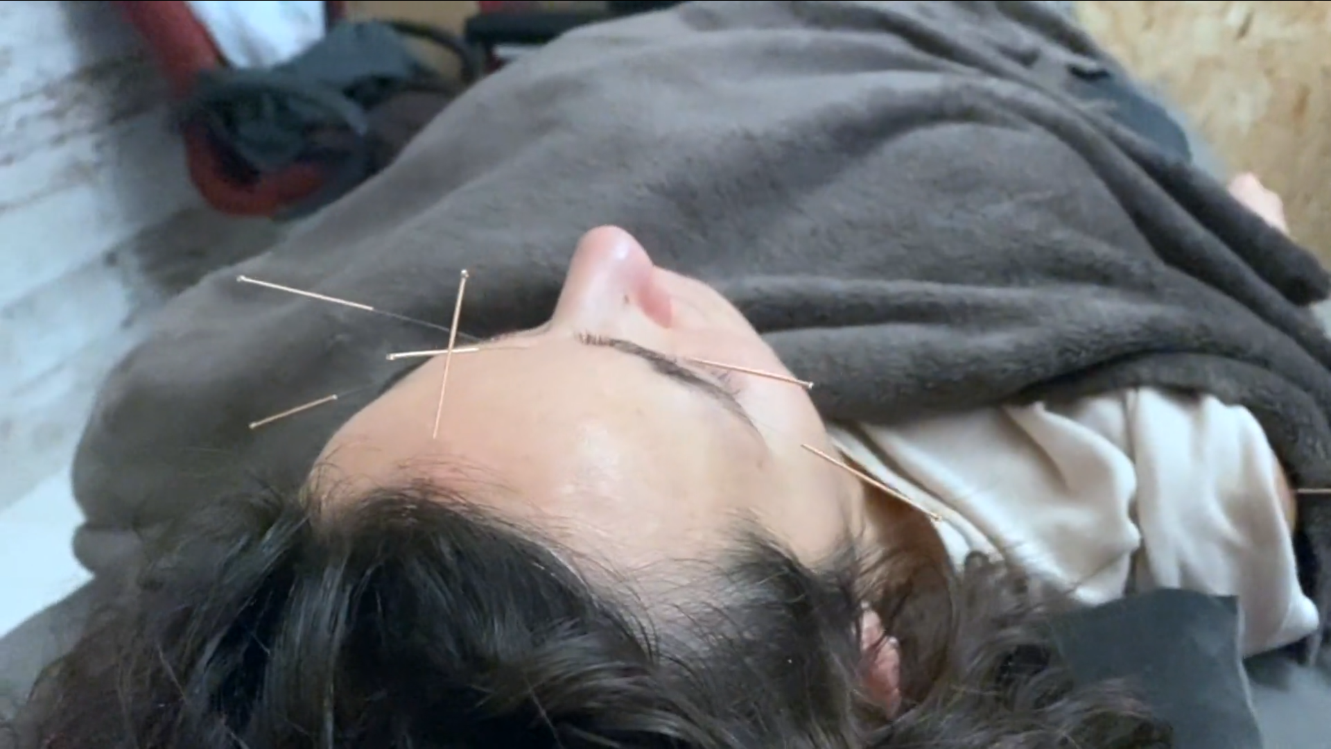 Aplicación de puntos de acupuntura en la cara para aliviar el estrés y la ansiedad a una alumna durante el curso de MTC-Acupuntura Clásica en el centro de formación HARA en Madrid.
