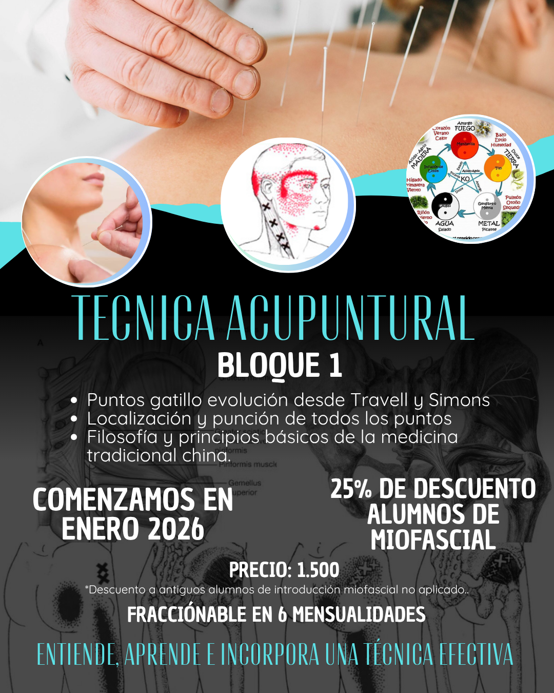 Póster que ilustra diversas técnicas acupunturales, utilizado como material didáctico en el centro de formación HARA para la enseñanza de la Medicina Tradicional China.